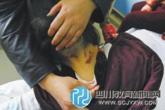 5歲女童在幼兒園被火鉗燙傷 幼兒園反稱(chēng)